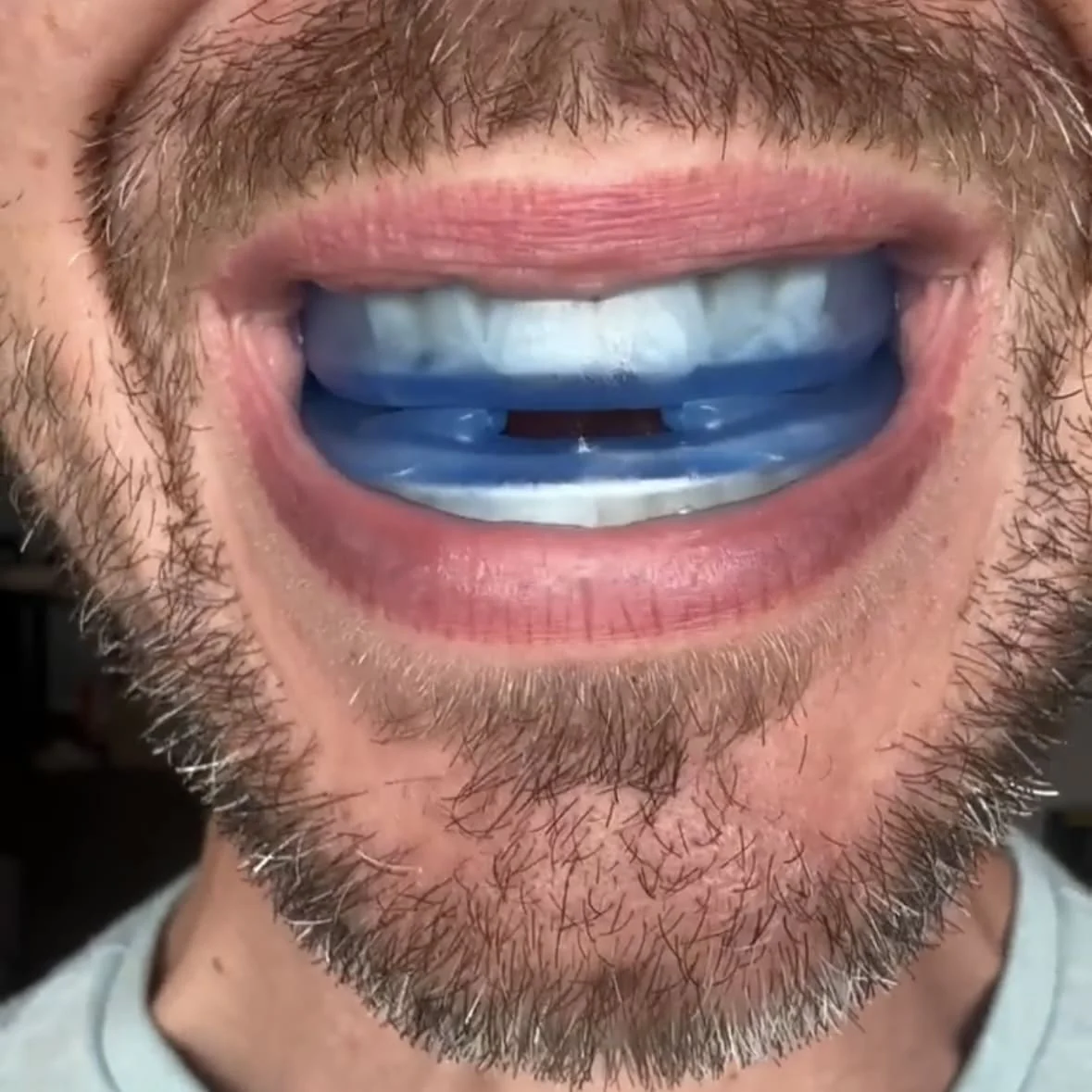 Vitalessent® Anti-snorren